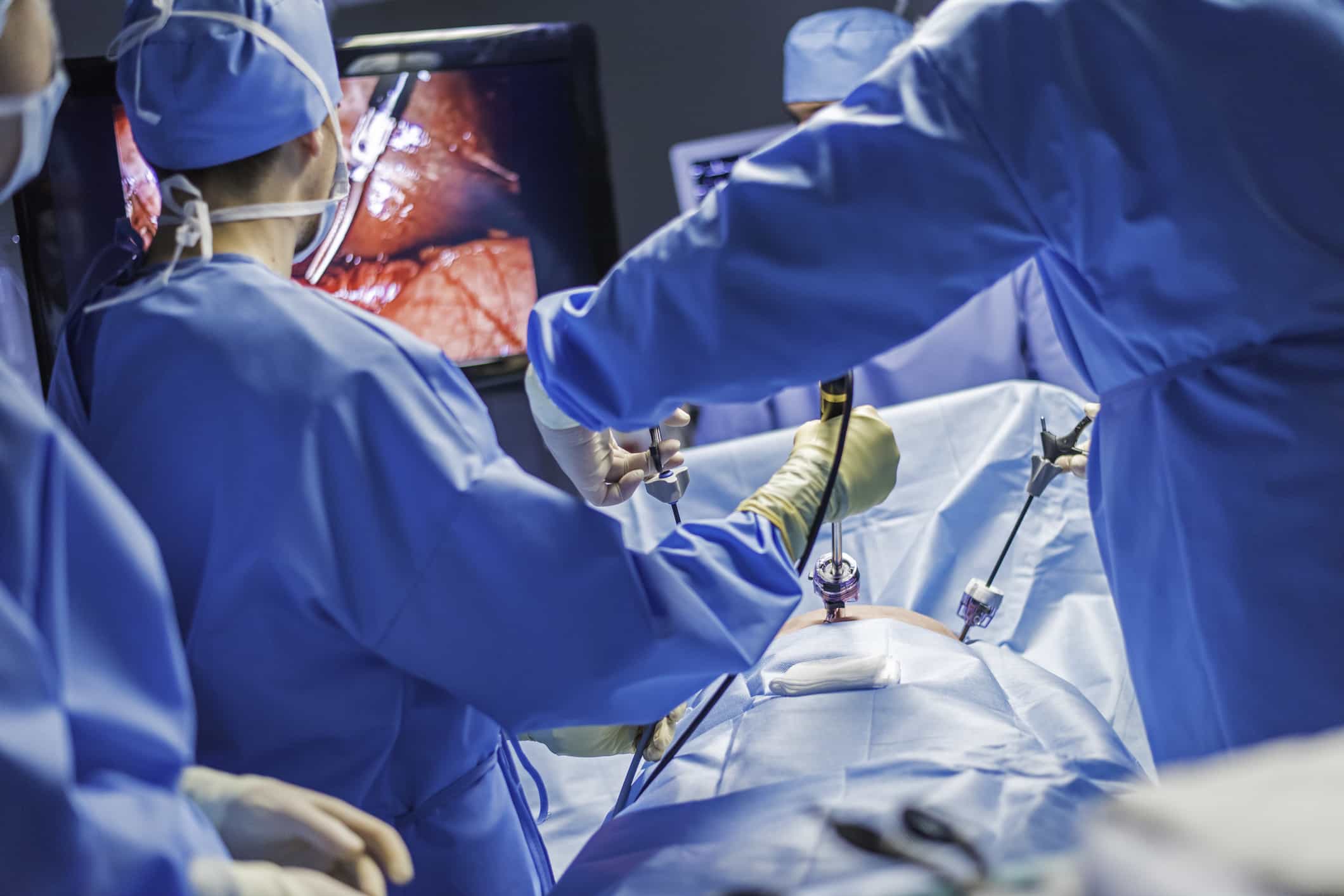 Laparoscopic Hernia Repair